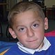 Duchenne muscular dystrophy