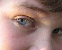 Young people do not know who to talk to about self-harm.