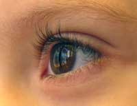 New research into nystagmus launched